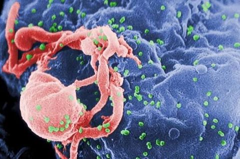 Choosing a Laboratory Automation System for Clinical Bacteriology: Key Considerations